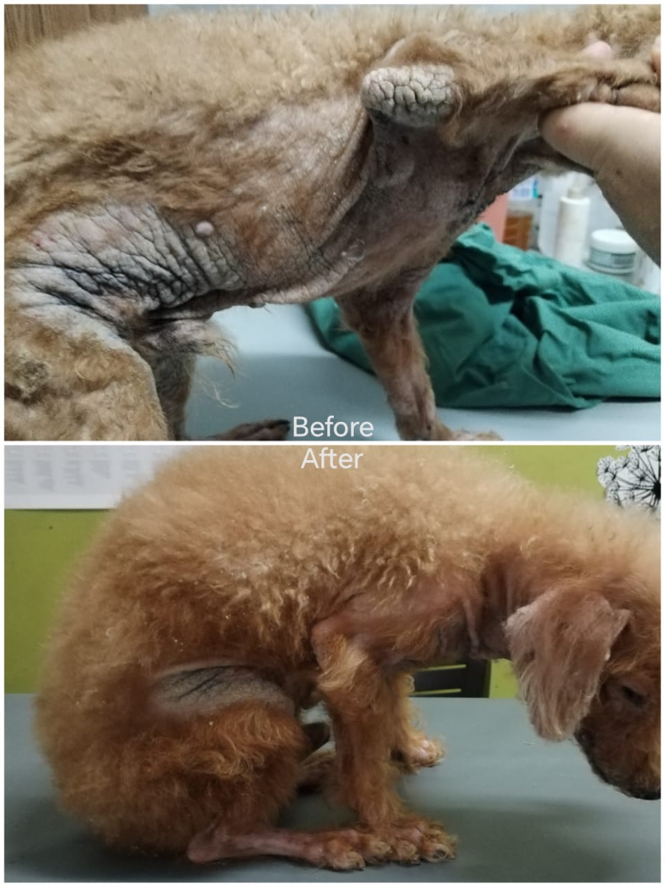 背中・首元の脱毛と赤み